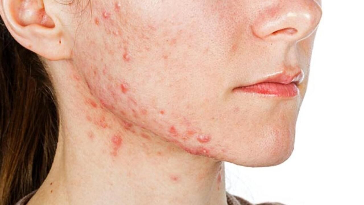 Sivilcelerinizle sakın oynamayın! Ürkütücü sonucu duyunca çok şaşıracaksınız