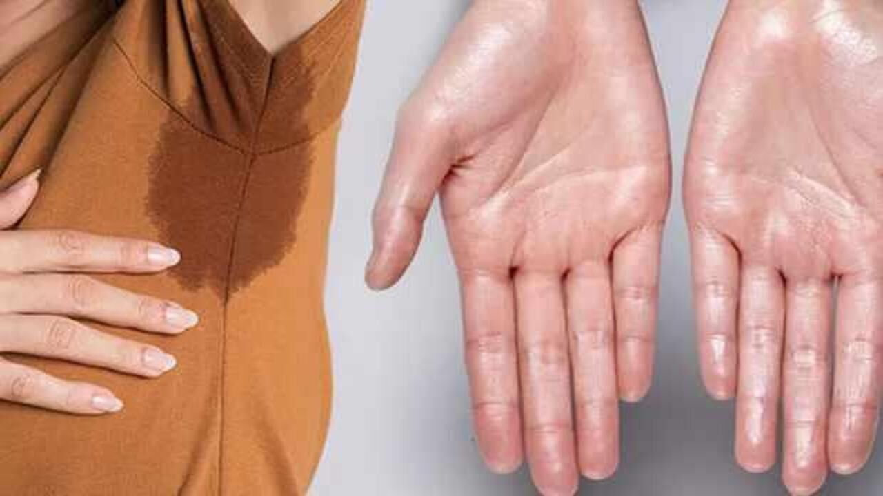 Aşırı terleme neden olur? Aşırı terleme nasıl geçer, hangi hastalığın belirtisi?