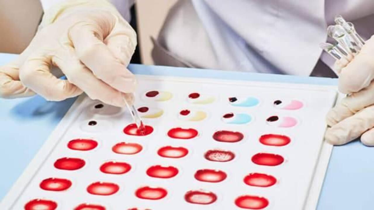 Kan gruplarına göre beslenme listeleri! Kan grubu özellikleri nelerdir?