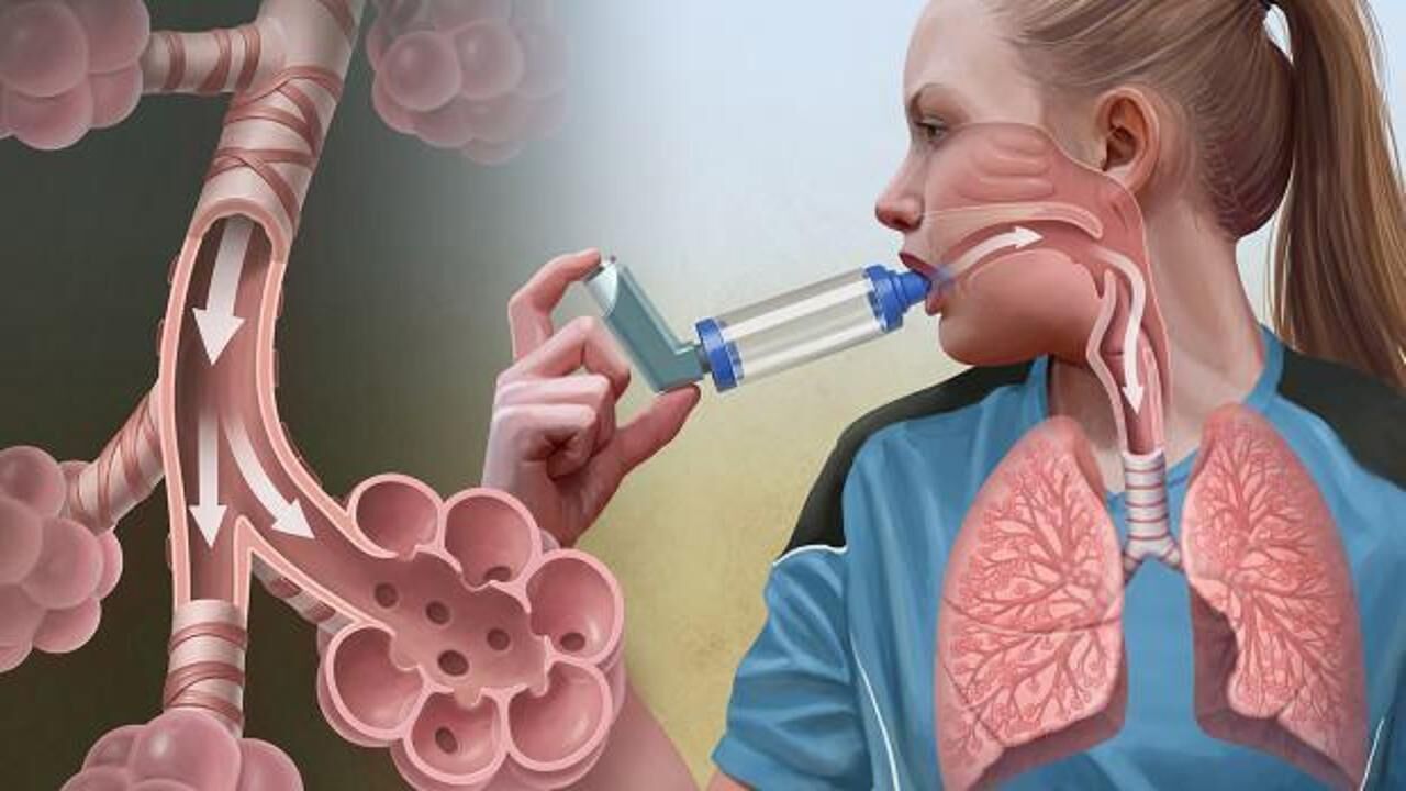 Klima ile bulaşan lejyoner hastalığı nedir, belirtileri nelerdir? Lejyoner hastalığı bulaşıcı mıdır?