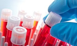 Uzmanı uyardı: "Kan tahlili hayat kurtarabilir"