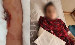 Büyükçekmece’de akran zorbalığı, arkadaşının kolunu 2 yerden kırdı