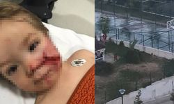 Ankara’da pitbull saldırısı: Sahibinin ihmali kamerada