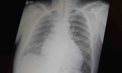 Profesör açıkladı: "Metamfetamin ve kokain gençler arasında tehlikeli boyutlara ulaştı"