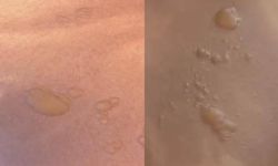 Sıcak su torbası tehlikesi yeniden gündemde: “3 dakika sonra patladı”