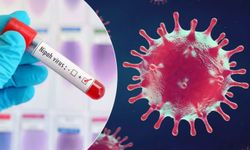 Profesör’den Nipah virüsü açıklaması