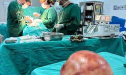 Van’da başarılı operasyon: 35 santimetrelik dev kitle alındı