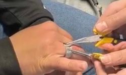 Yüzüğü Parmağına Sıkışan Vatandaş İtfaiye Ekipleri Tarafından Kurtarıldı