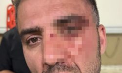 Van'da sağlıkta şiddet: Hastane personeli darp edildi