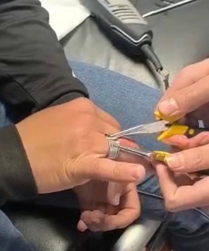 Yüzüğü Parmağına Sıkışan Vatandaş İtfaiye Ekipleri Tarafından Kurtarıldı