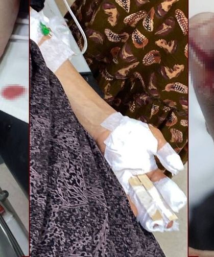 Şırnak’ta başıboş köpek dehşeti: 3 yaralı