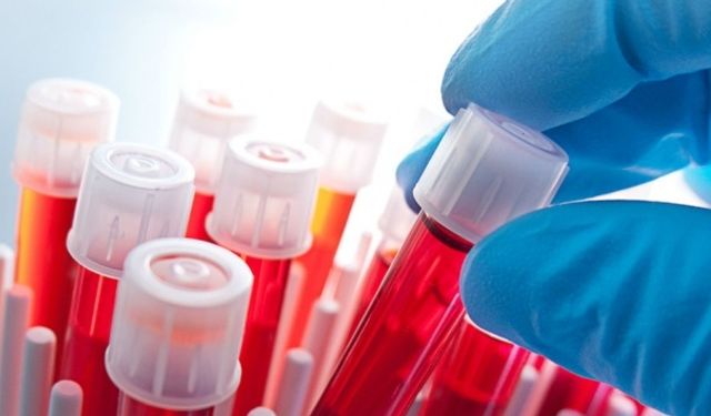 Uzmanı uyardı: "Kan tahlili hayat kurtarabilir"
