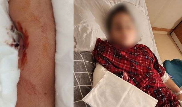 Büyükçekmece’de akran zorbalığı, arkadaşının kolunu 2 yerden kırdı