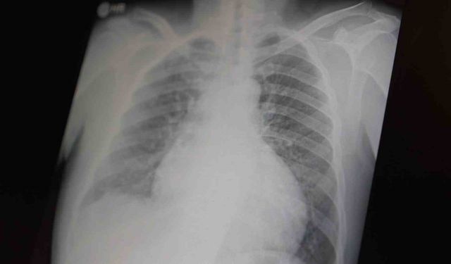 Profesör açıkladı: "Metamfetamin ve kokain gençler arasında tehlikeli boyutlara ulaştı"