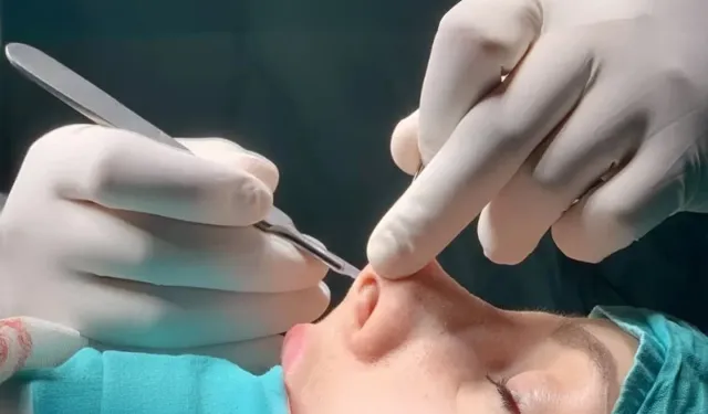 Burun Eti Büyümesine Karşı Etkili Çözüm: Radyo Frekans Yöntemi