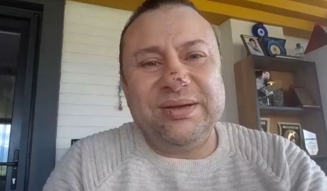 Pitbull saldırısına uğrayan Onur Akay o anları anlattı