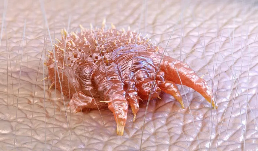 Türk Dermatoloji Derneği’nden ‘Uyuz’ açıklaması