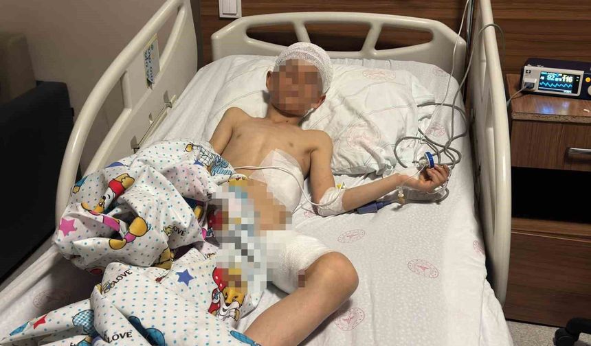 Van’daki Köpek Saldırısında Kan Donduran Detaylar: 13 Köpek Çocuğu Parçaladı