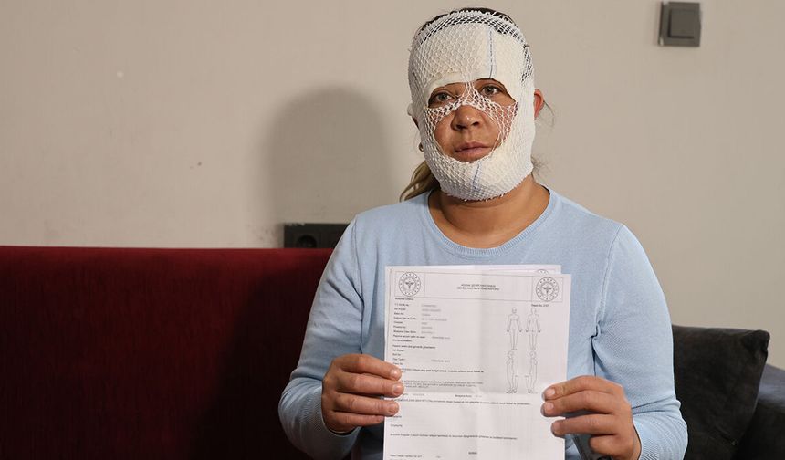 Güzellik hayali kabusa döndü