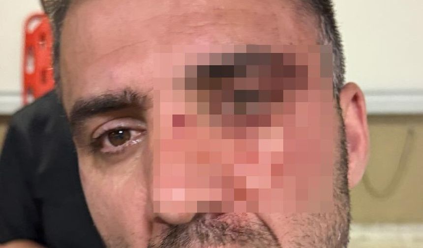 Van'da sağlıkta şiddet: Hastane personeli darp edildi