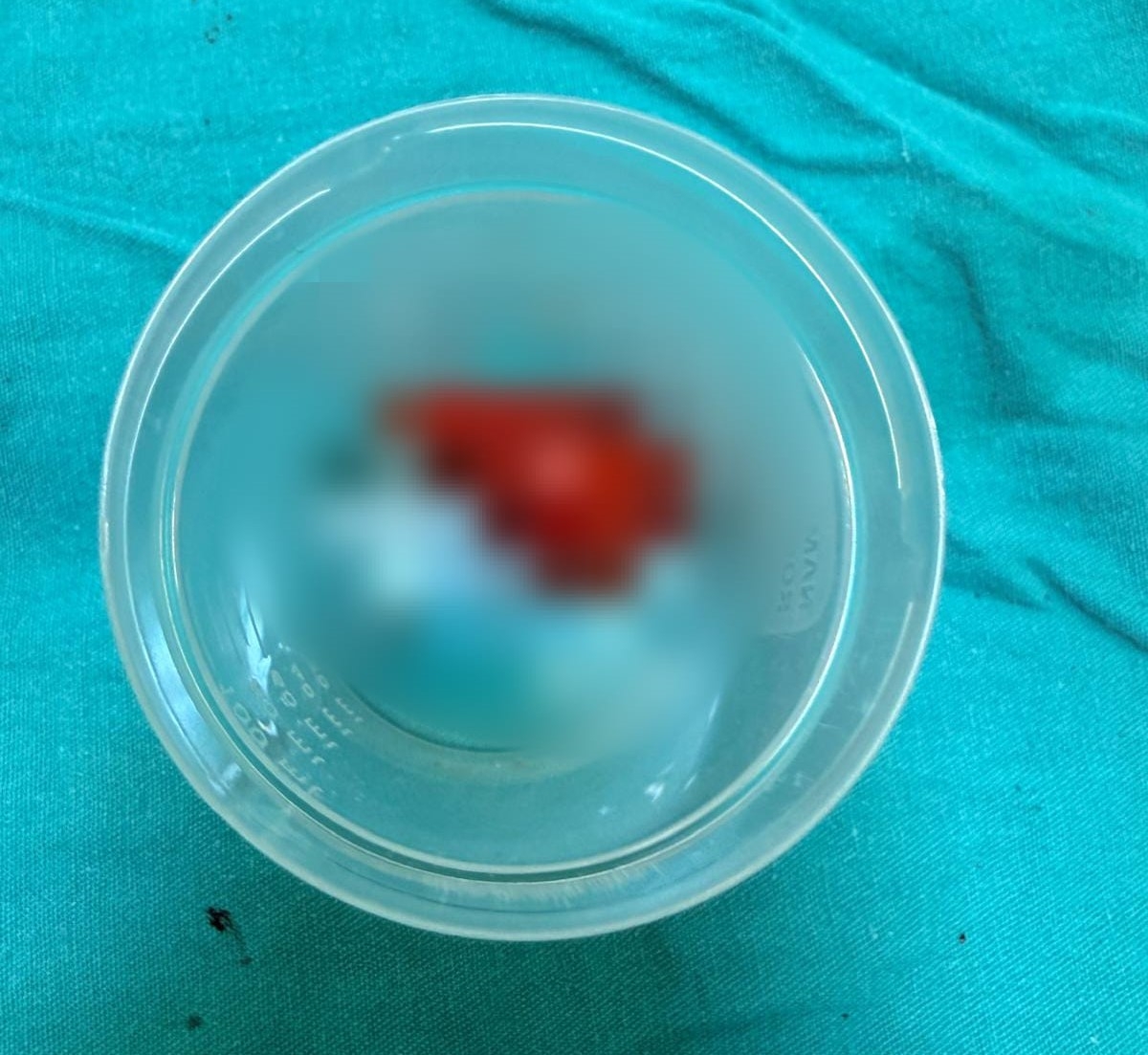 Cf1F1Da8 7Ff8 49Ad 8793 Ee56Ebe371F3