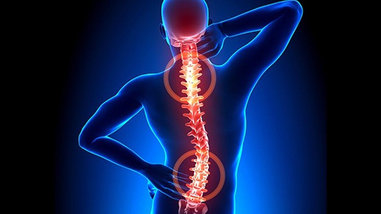 İlerlemiş boyun fıtığı belirtileri nelerdir? Boyun fıtığı nasıl geçer?