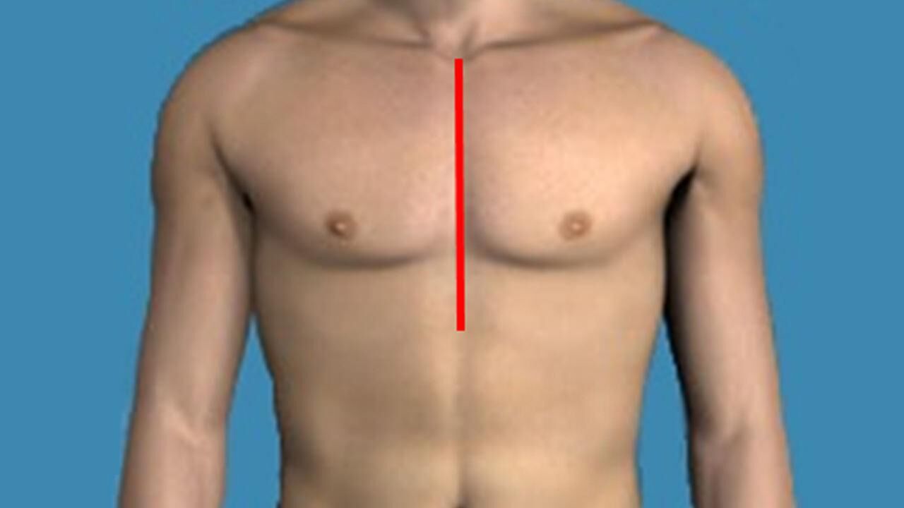 Kalp ameliyatları kabus olmaktan çıkıyor! Küçük kesi kalp cerrahi mucizesi…