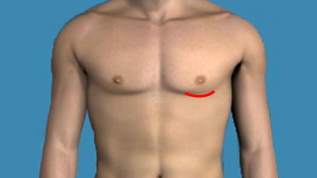 Kalp ameliyatları kabus olmaktan çıkıyor! Küçük kesi kalp cerrahi mucizesi…