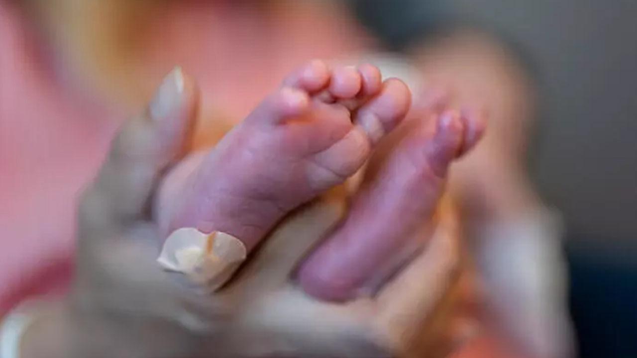 Fenilketonüri hastalığı nedir, belirtileri nelerdir? Bebeklerde fenilketonüri hastalığı belirtileri...