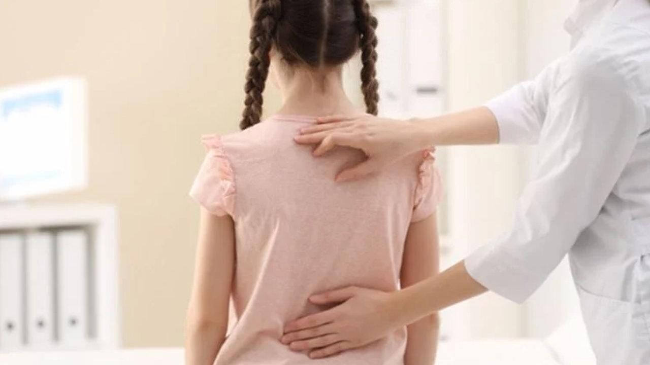 Skolyoz nedir,  tedavisi var mı? Skolyoz hastalarının görüntüsü...