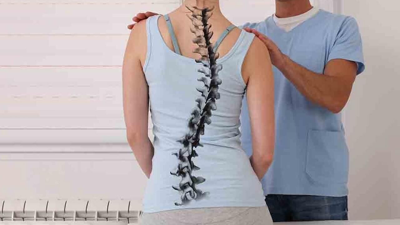 Skolyoz nedir,  tedavisi var mı? Skolyoz hastalarının görüntüsü...