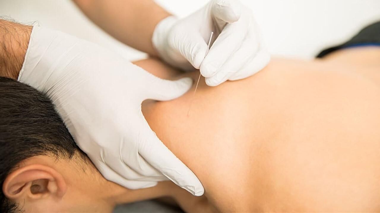 Fibromiyalji tedavisi ve ağrı noktaları: Fibromiyalji kuru iğne tedavisi nedir?