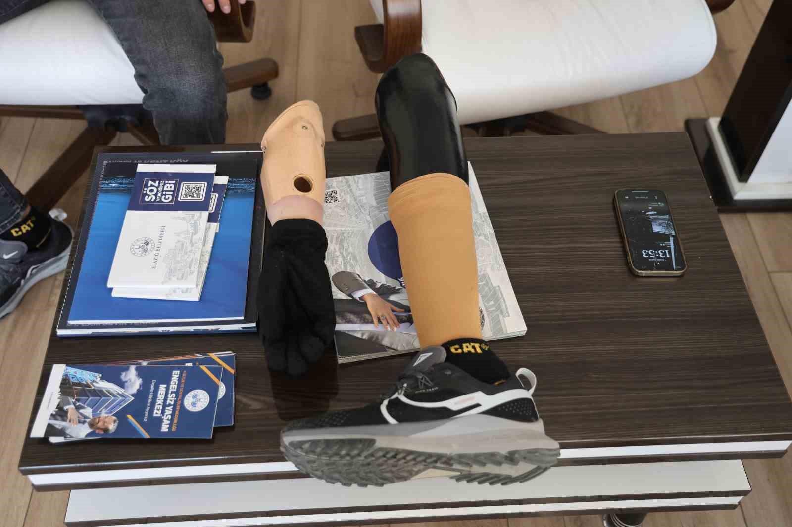 Sağ eli ve sol dizini kaybetti, yaşam sevincini kaybetmedi