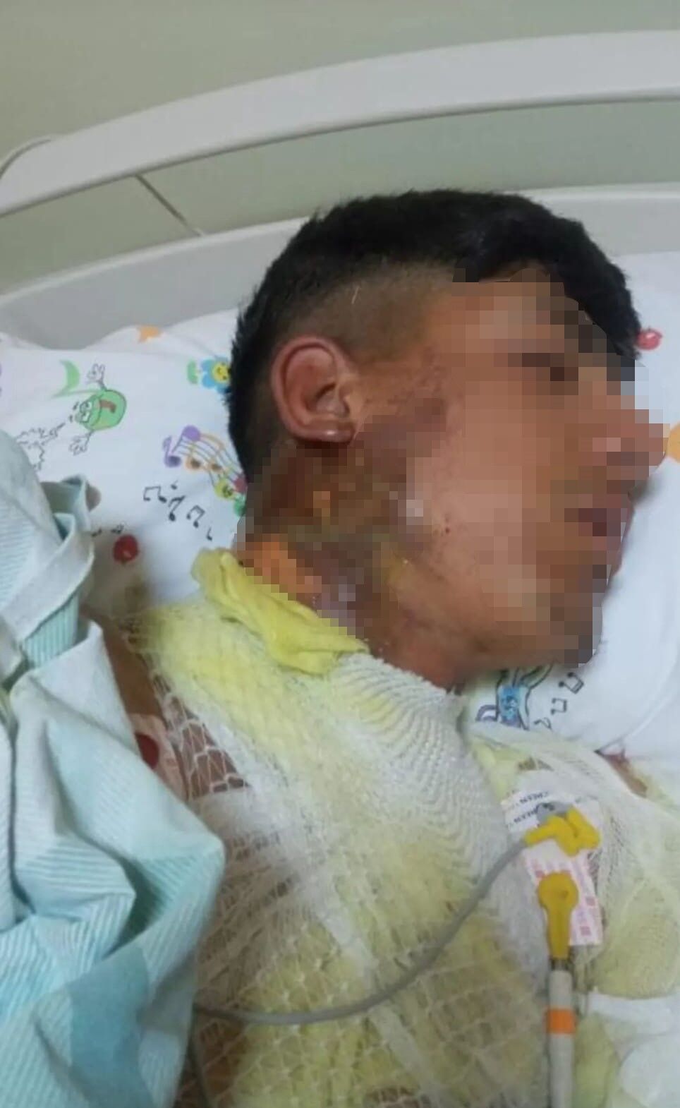 Iğdır’da yıldırım düşmesi sonucu, 2 kardeş yaralandı 20 koyun telef oldu