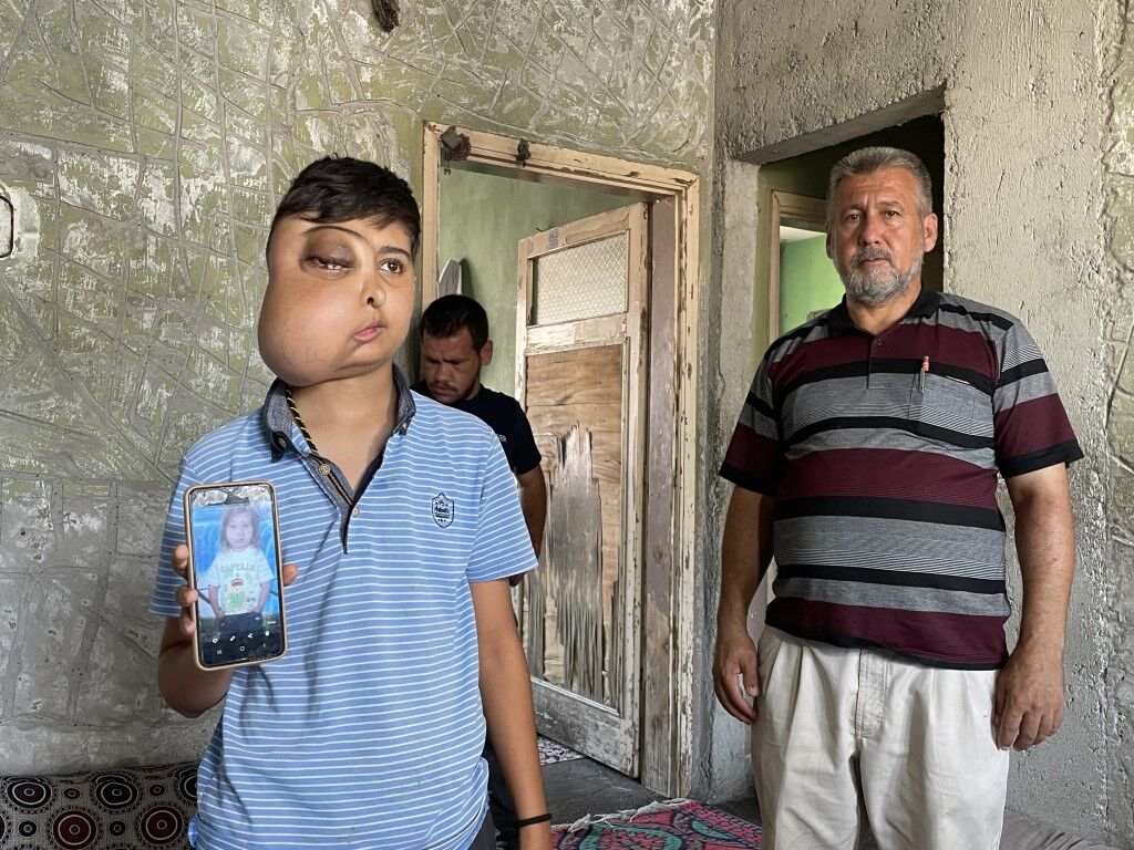 İki farklı yüzü var gibi görünen çocuğun tek isteği iyileşip gülmek