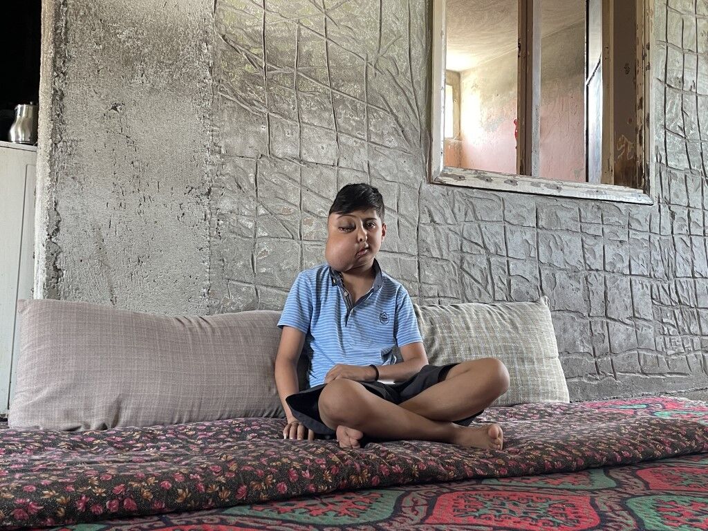 İki farklı yüzü var gibi görünen çocuğun tek isteği iyileşip gülmek