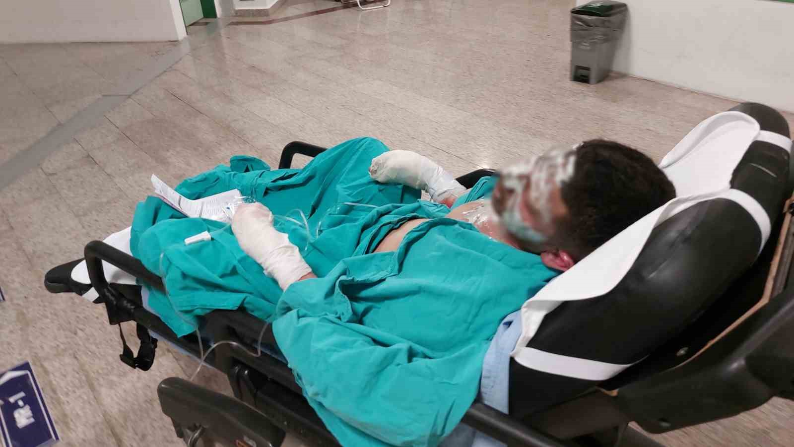 Yaktığı ateşe tiner döken genç ağır yaralandı