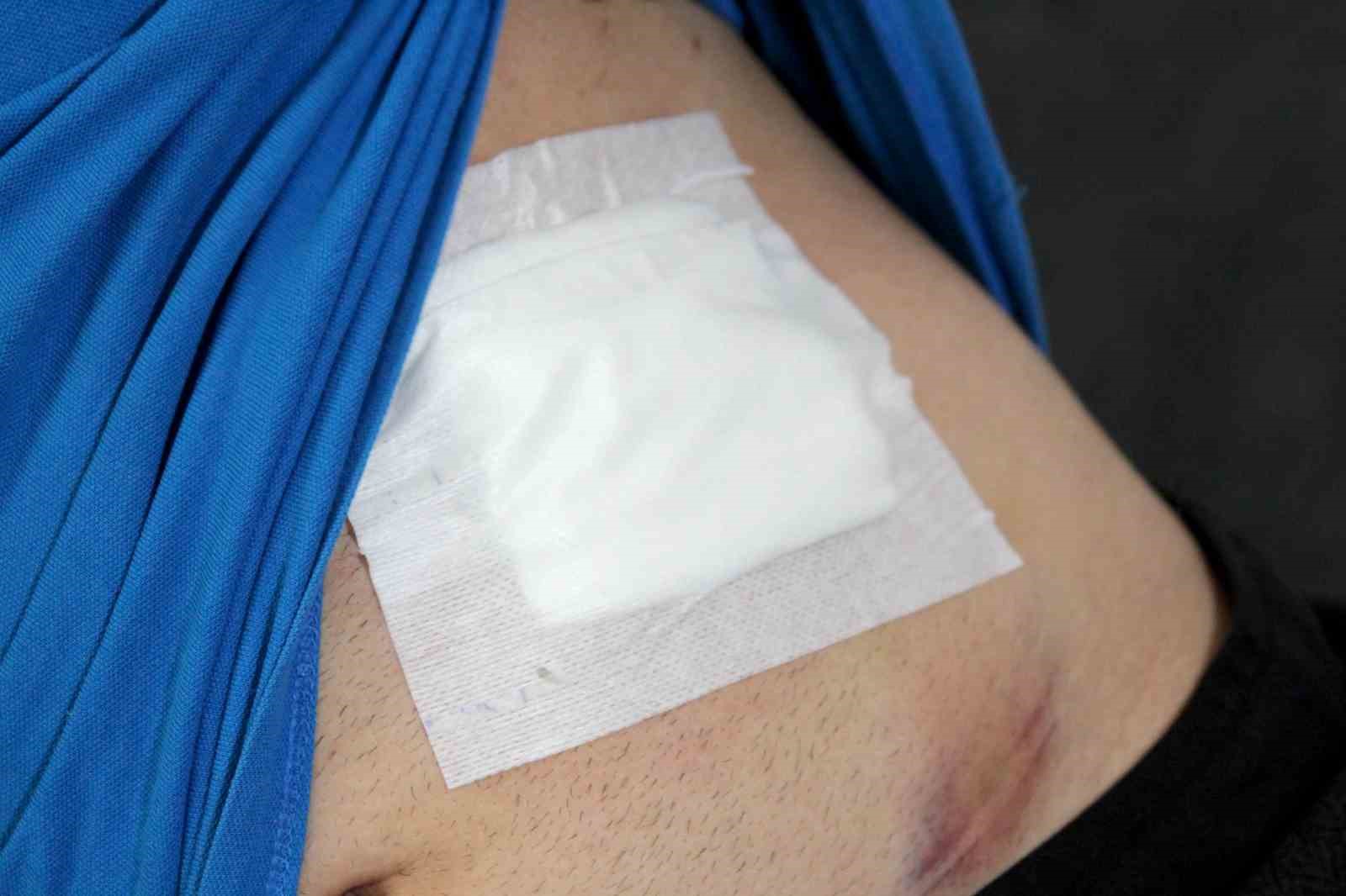 Bayramlaşmaya gitti, karnına yorgun mermi isabet etti