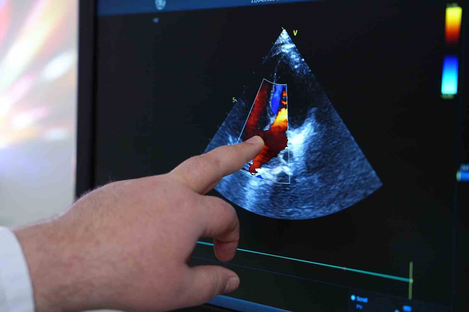 Çocuklarda hipertansiyon gizlice ilerliyor