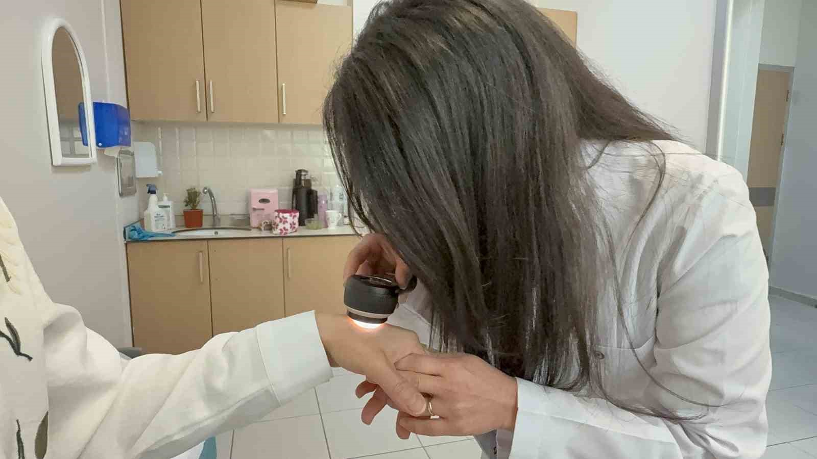 Güneşe dikkat: Alerji vakalarında artış başladı