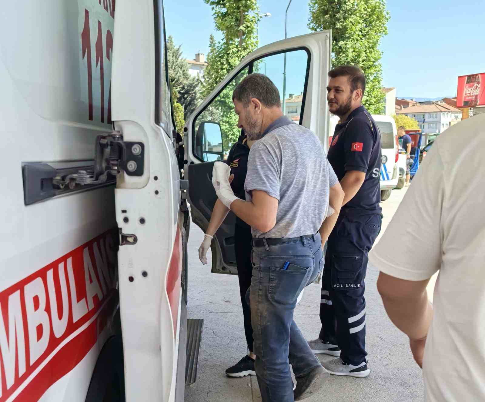 Elini bıçkıya kaptıran adamın parmakları parçalandı