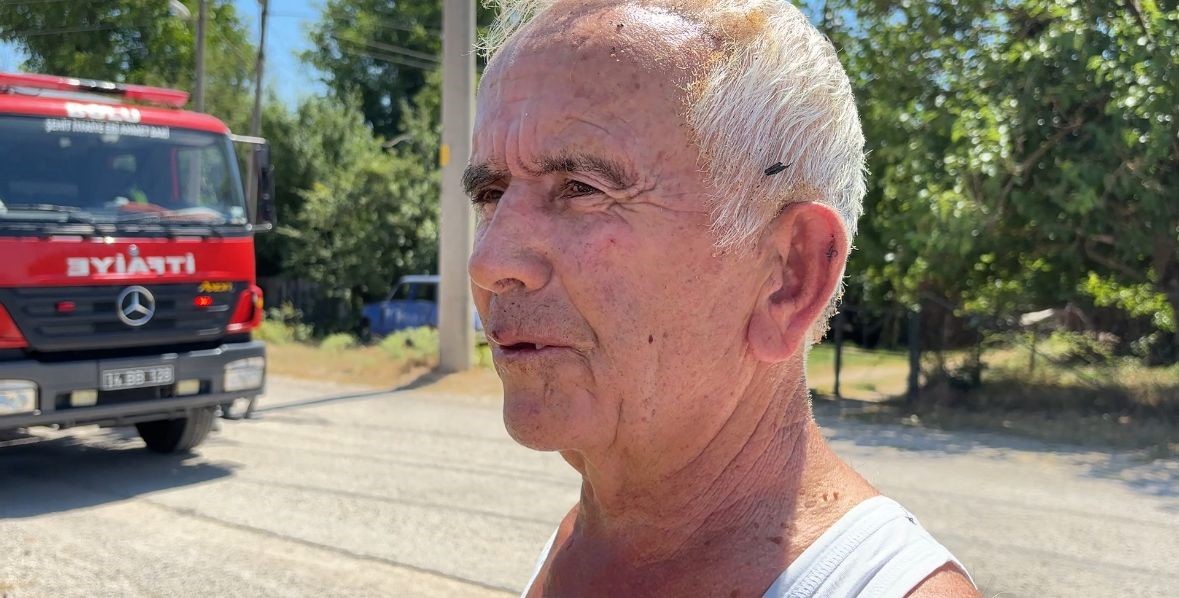 Çöpleri yakmak isterken kendini de yaktı