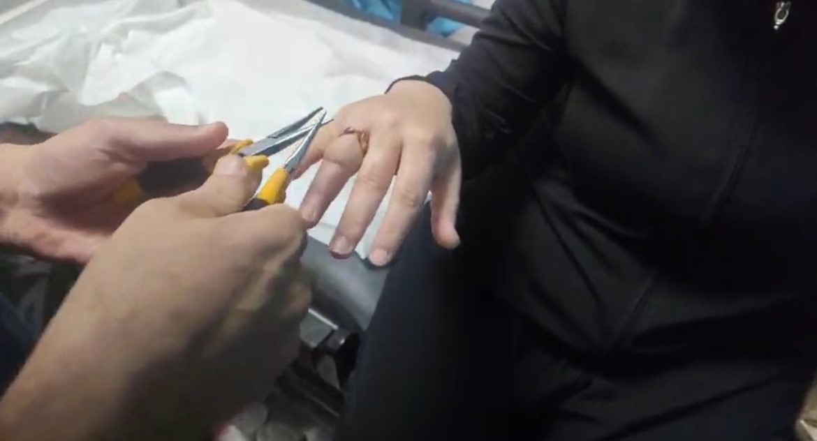 Kadının parmağına sıkışan yüzük, itfaiye ekibince hastanede çıkarıldı