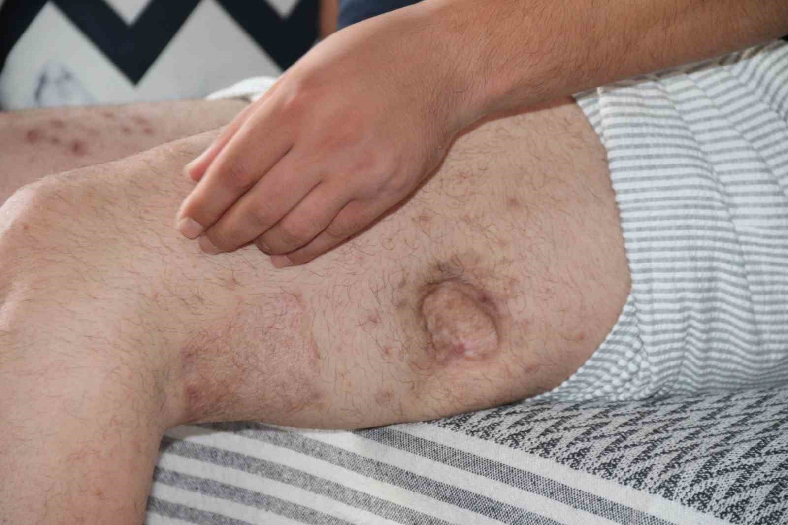 (ÖZEL) Kendisine iyilik yapmaya çalışan akrabasını önce vurdu, sonra da icra davası açtı