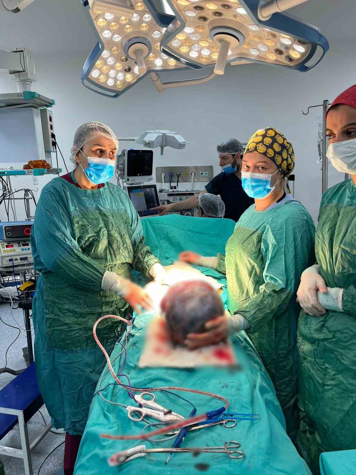 Operasyona alınan hastanın karnından ’dev tümör’ çıktı