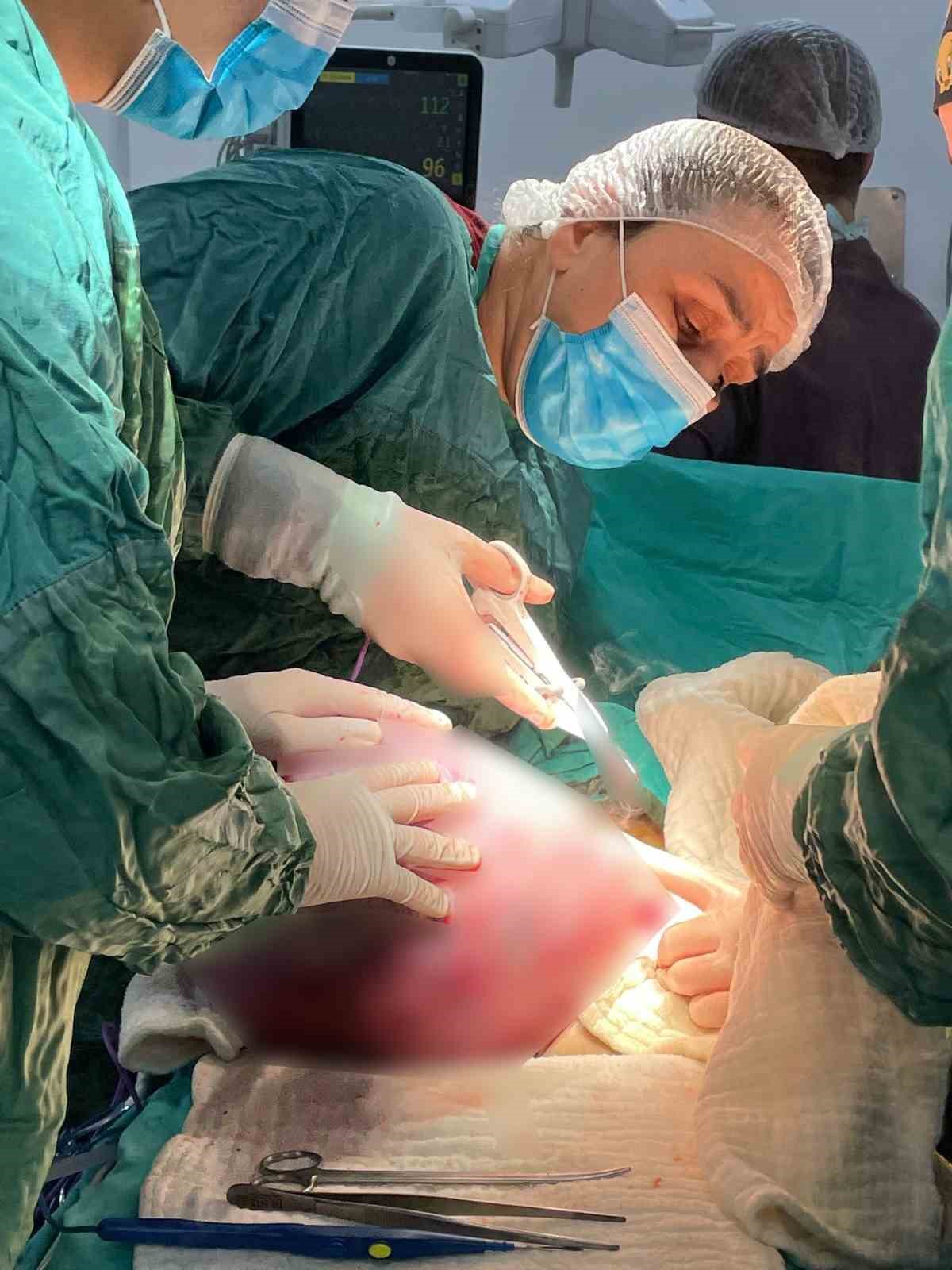 Operasyona alınan hastanın karnından ’dev tümör’ çıktı