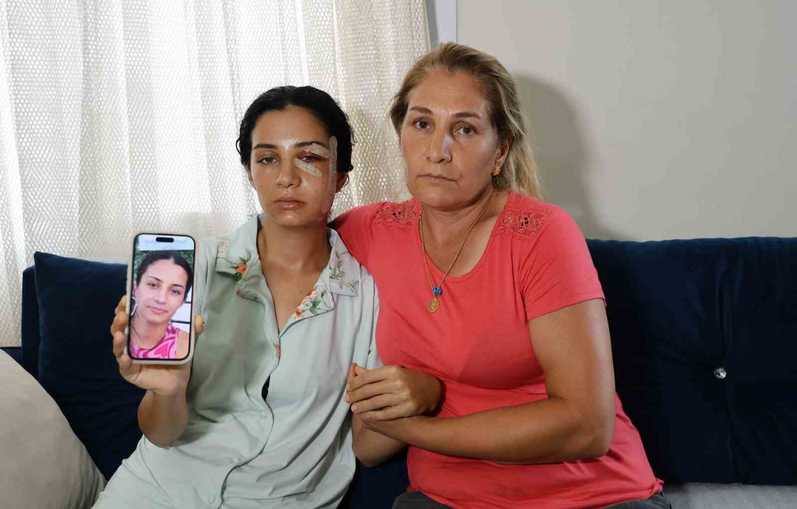 Eski eşini dövüp serbest kalan şüpheli tutuklandı