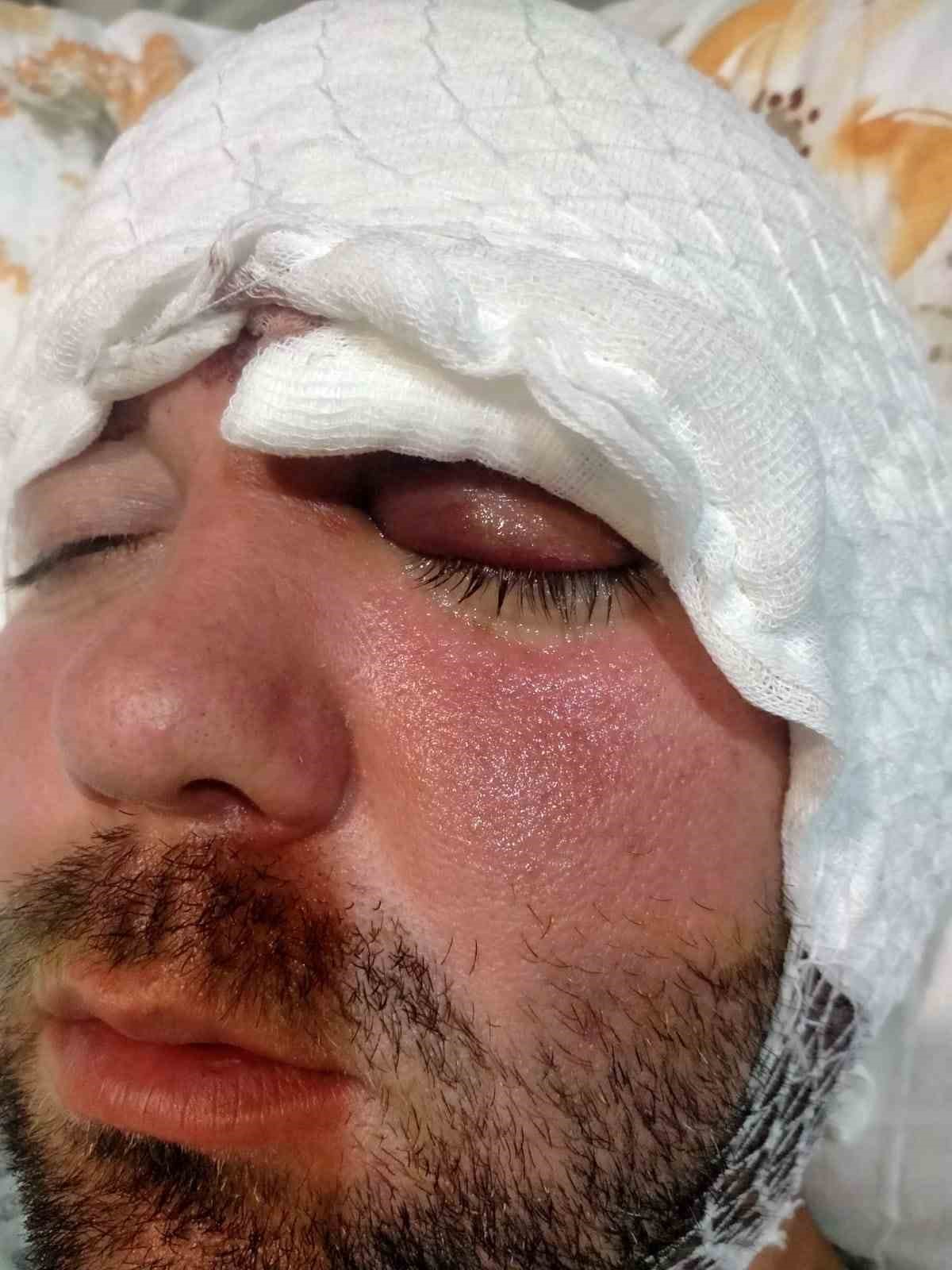 Beynine saplanan implant hayatını kararttı: 2 yıldır adalet bekliyor