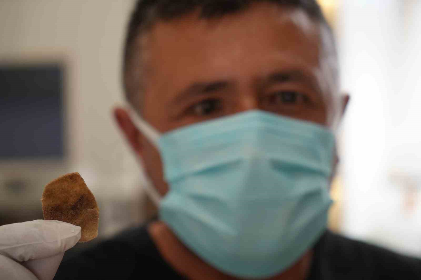 Protez gözü hayatını kabusa çevirdi