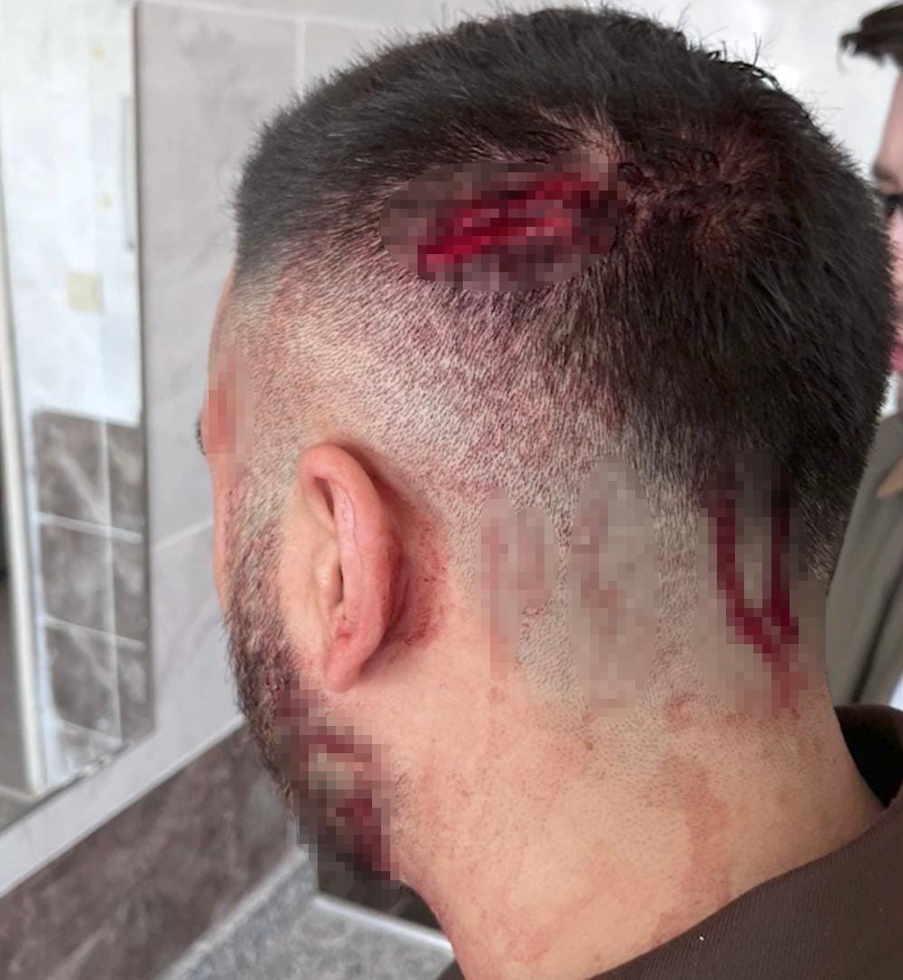 Şanlıurfa’da öğretmen, veli tarafından sopayla darbedildi